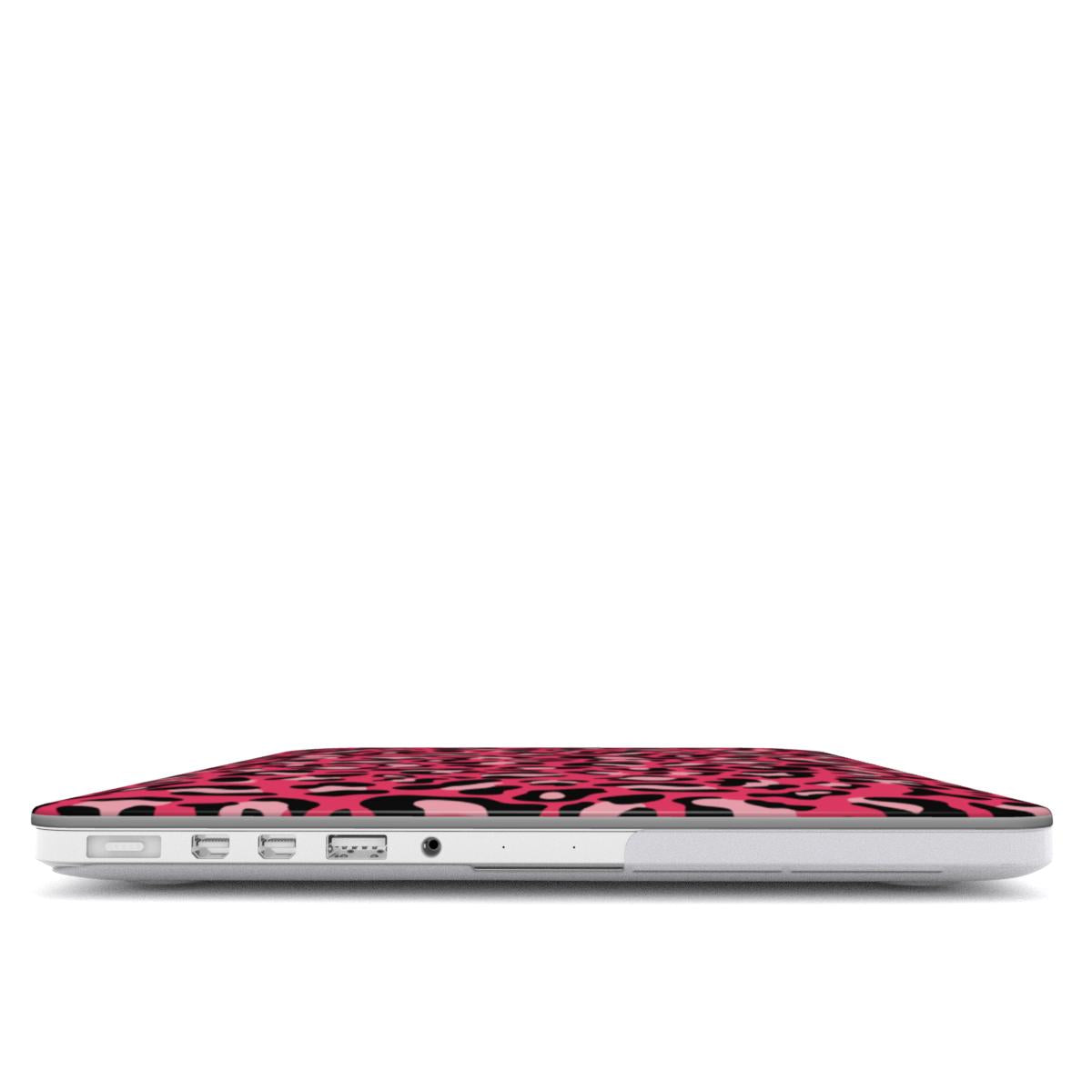 Pink Leopard Print MacBook Case