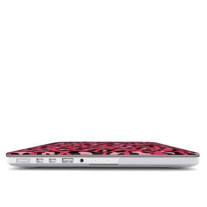 Pink Leopard Print MacBook Case